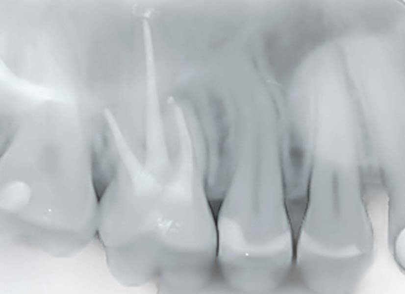 stomatologia endodoncja bielsko