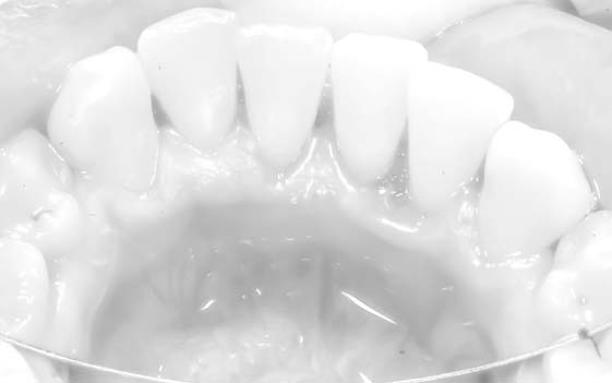 leczenie zębów bielsko