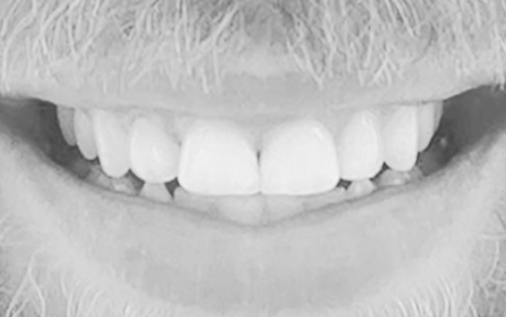 endodoncja bielsko