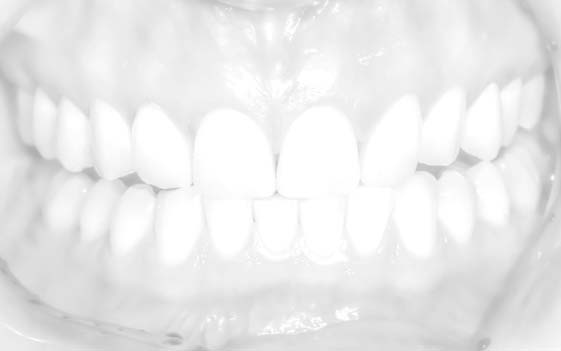 implanty zębowe bielsko