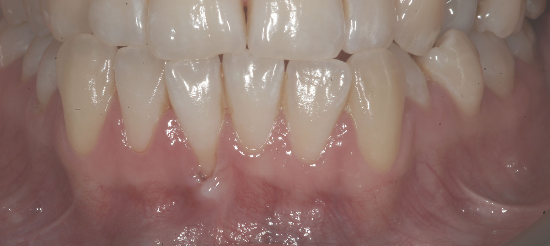 periodontologia dentysta bielsko