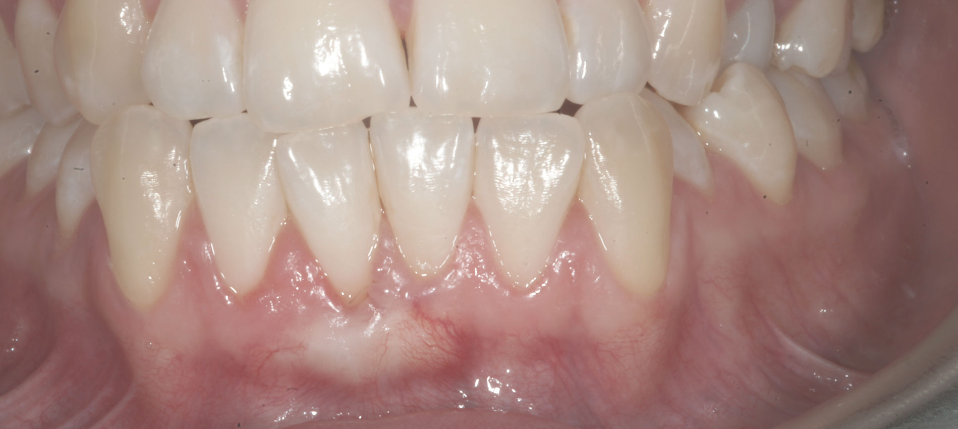 periodontologia bielsko-biała