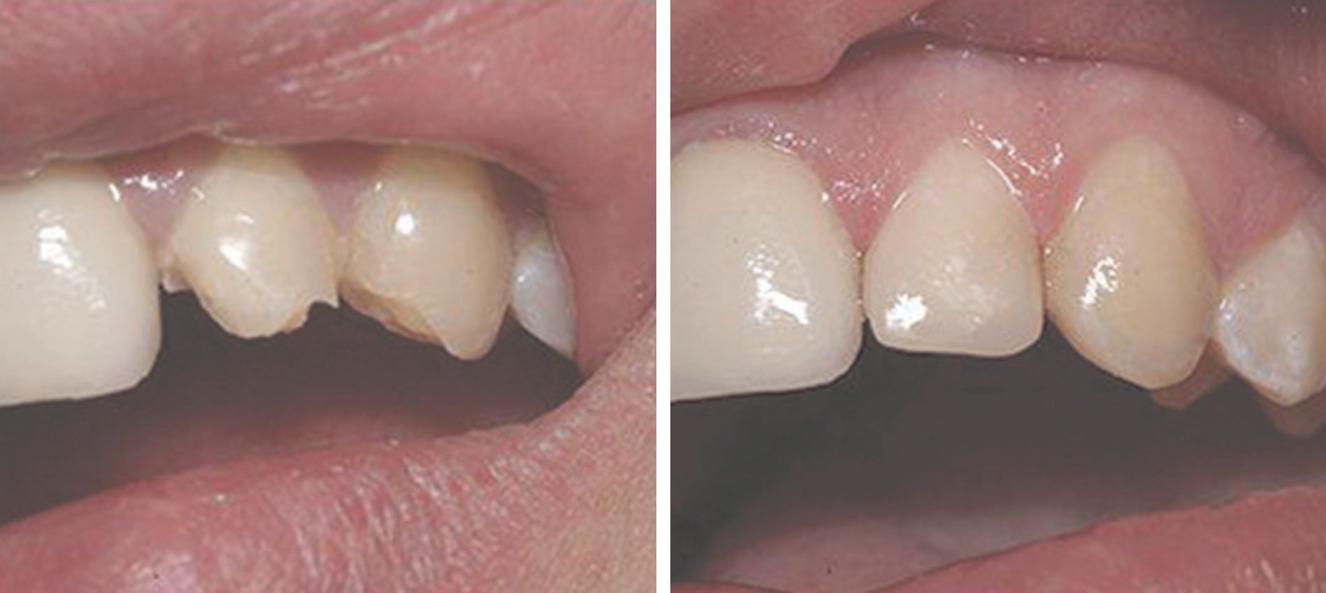 endodoncja bielsko-biała