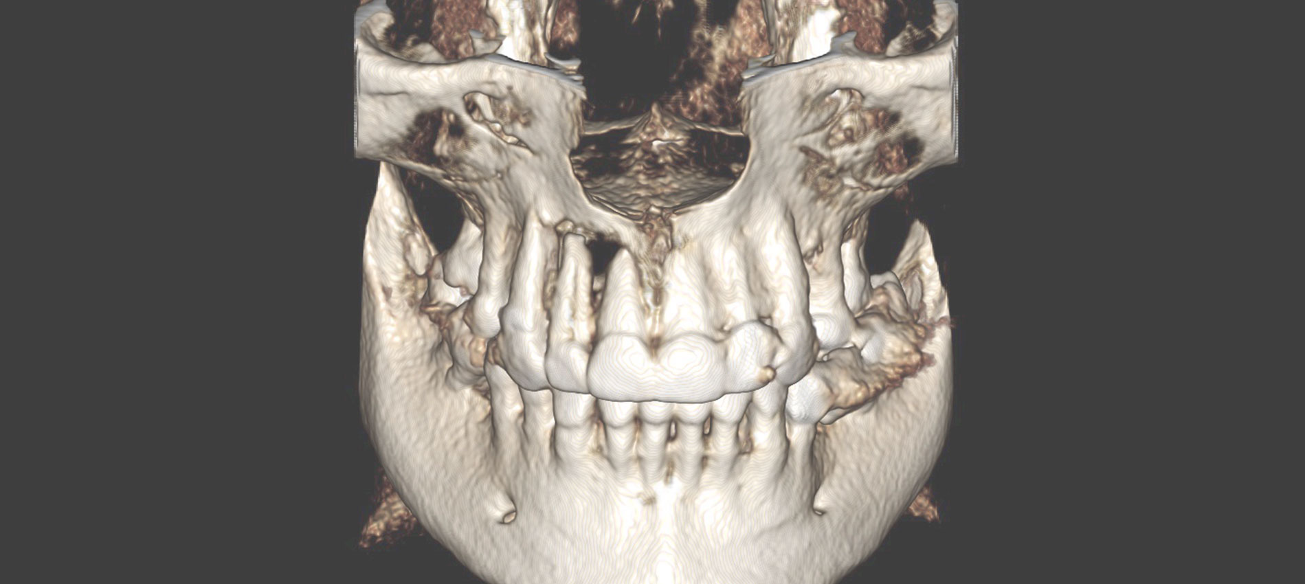 mikrochirurgia dentysta bielsko