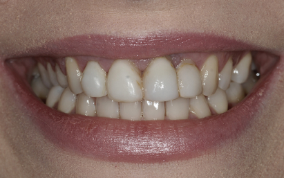 stomatolog bielsko-biała
